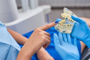 dentist showing patient model of teeth with metal braces